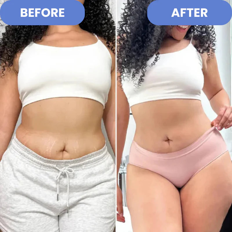 SculptEase - Cellulite Treatment 4-in-1